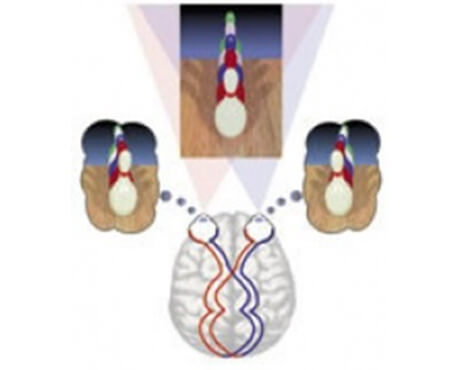 Visual Perceptual delays